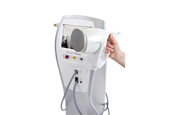 Accent Prime Ultrasound & Radiofrequency – Primas Medispa