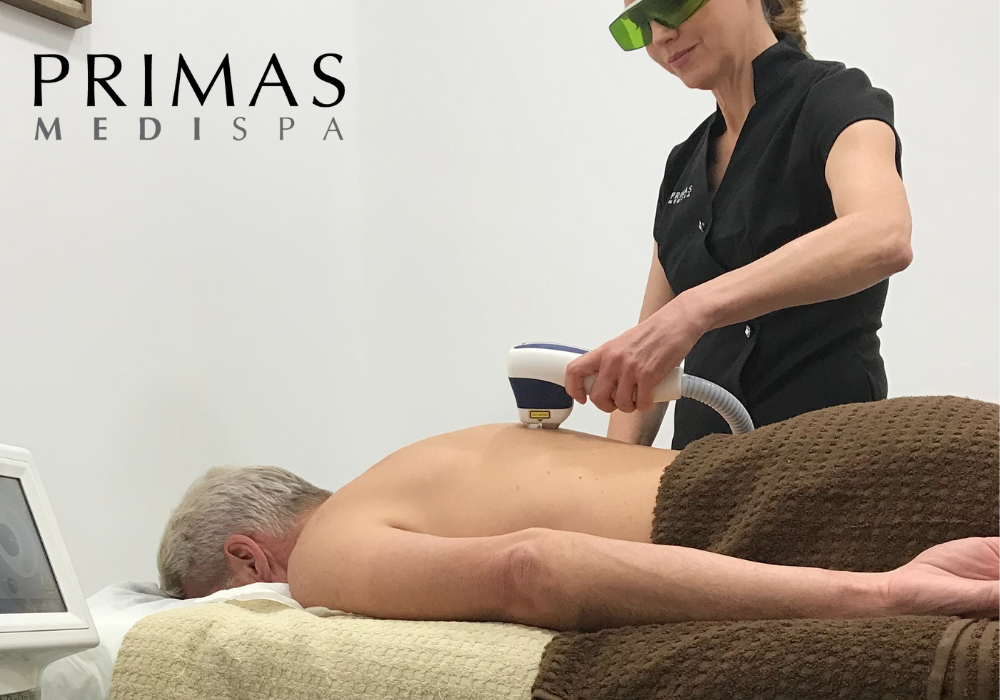 Laser Hair Removal for Men at Primas Medispa