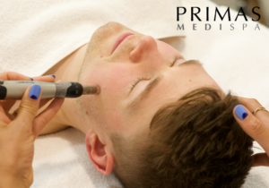 Dermapen Microneedling at Primas Medispa