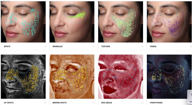 Visia Skin Analysis