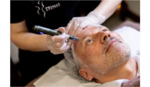 Microneedling & Skincare