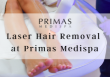 Laser Hair Removal at Primas Medispa London